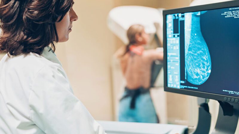 Inca prevê que Brasil terá 704 mil novos casos de câncer por ano até 2025