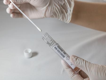 Anchieta: Município começa agendamento on-line para exame de RT-PCR