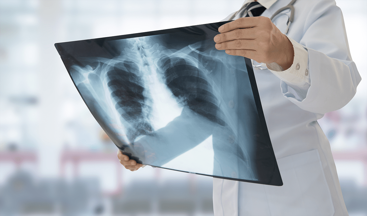 Síndromes respiratórias se aproximam de menor patamar da pandemia